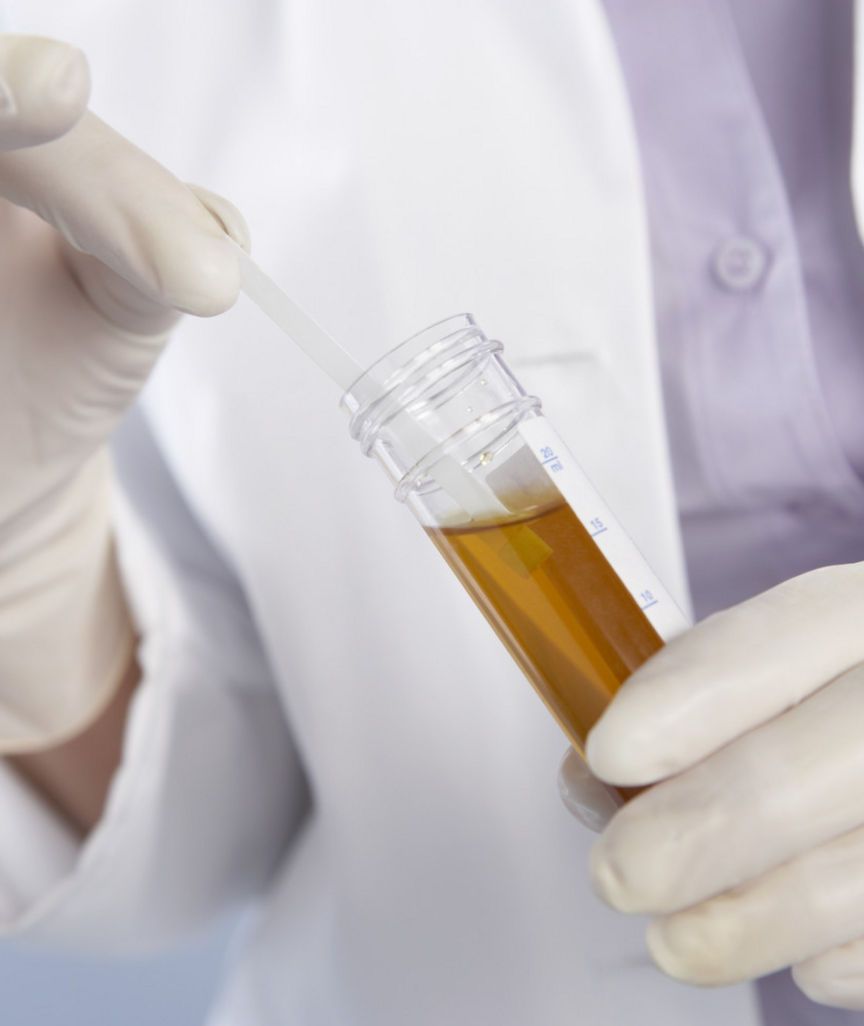 Urine Drug Testing Services